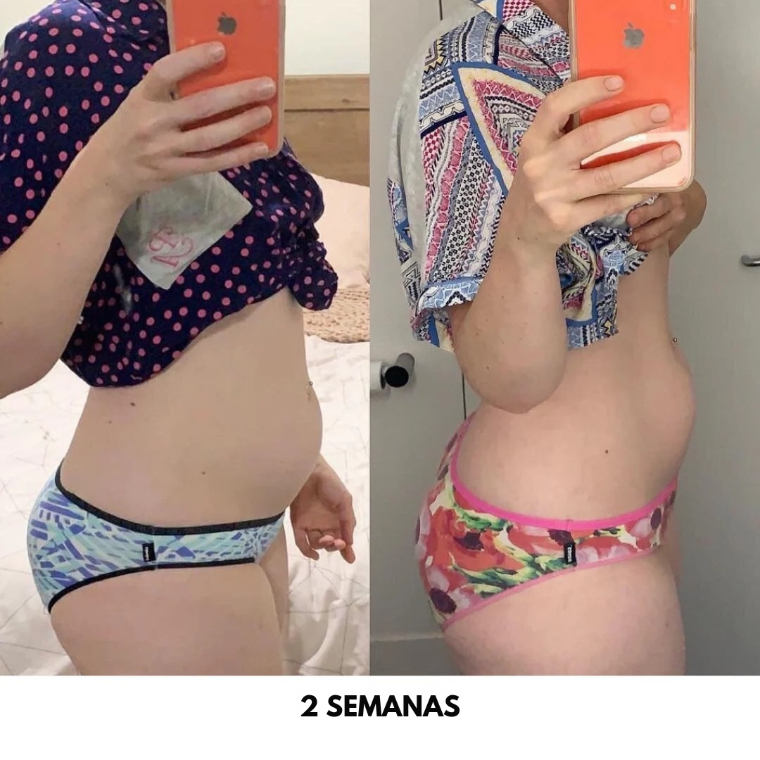 Pack 2x1 Fórmula Desinflamante y Purificadora ALUNA™ | Best Seller 2025