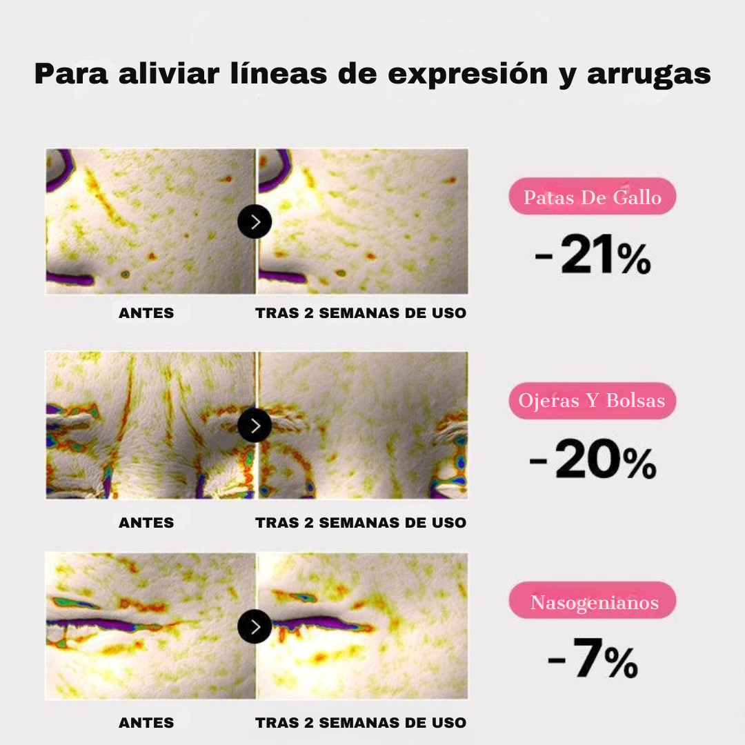 Set De Parches De Hidrogel Y Colágeno + Gel Hidratante (GRATIS) | Aluna™
