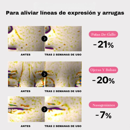Set De Parches De Hidrogel Y Colágeno + Gel Hidratante (GRATIS) | Aluna™