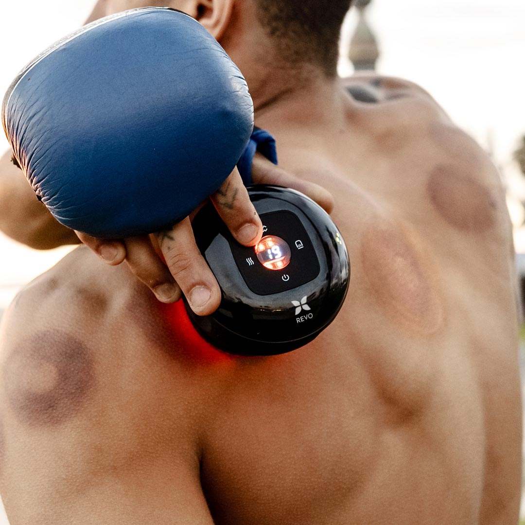 Set 2 Ventosas Inteligentes Con Cable ALUNA™ | Best Seller España 2025