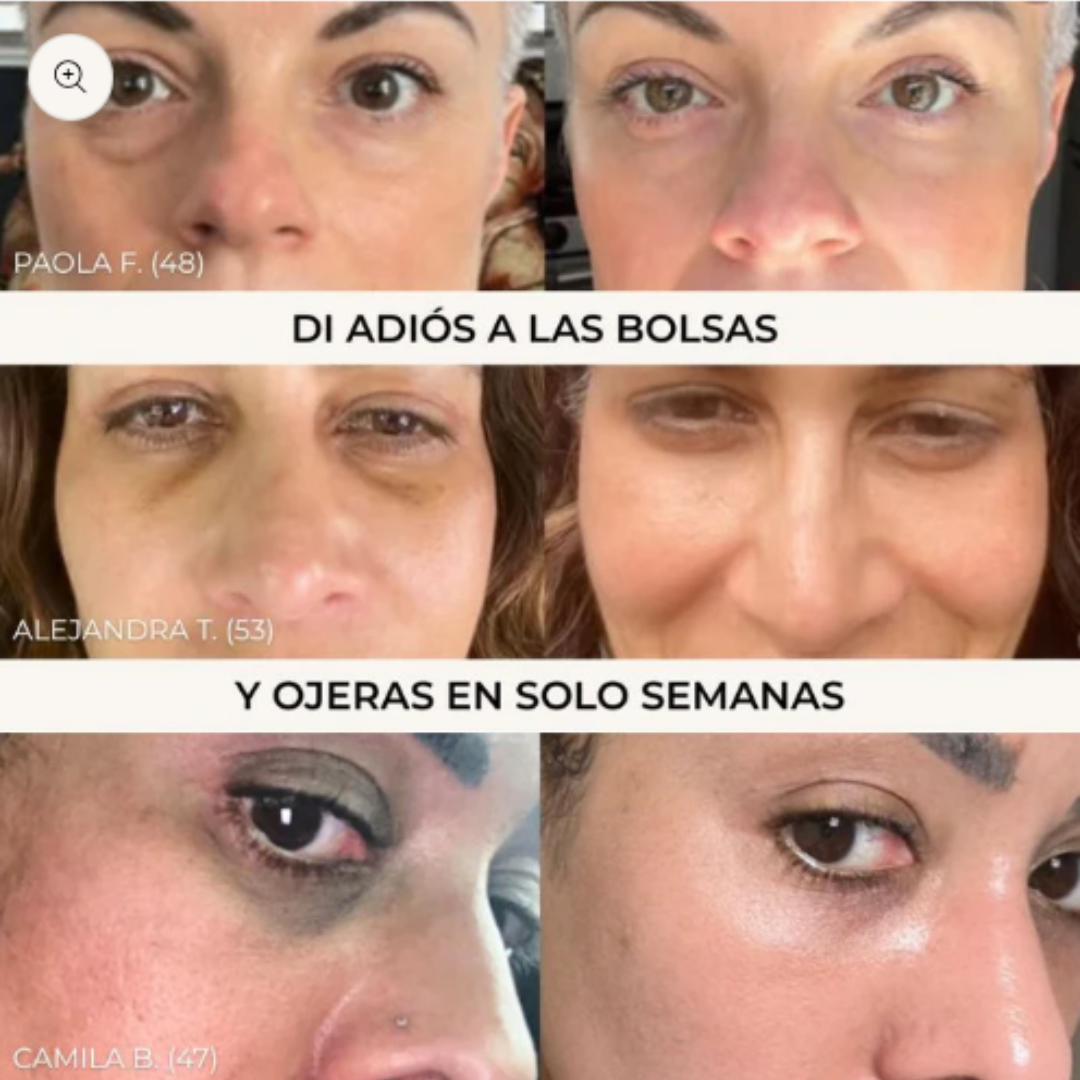 Parches De Colágeno ALUNA™ + 5 Mascarillas Gratis | SkinCare Nº1 2025