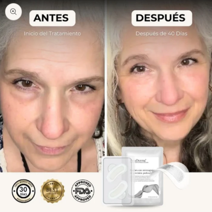 Parches De Colágeno ALUNA™ + 5 Mascarillas Gratis | SkinCare Nº1 2025