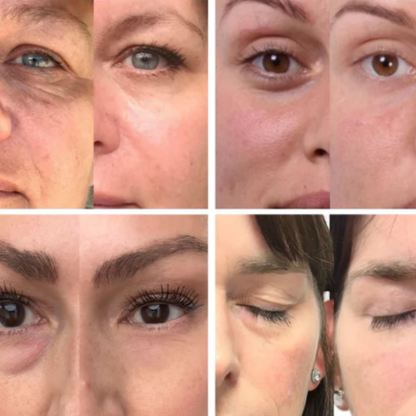 Parches De Colágeno ALUNA™ + 5 Mascarillas Gratis | SkinCare Nº1 2025