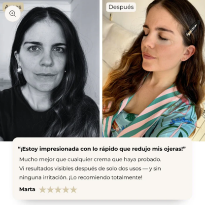 Parches De Colágeno ALUNA™ + 5 Mascarillas Gratis | SkinCare Nº1 2025