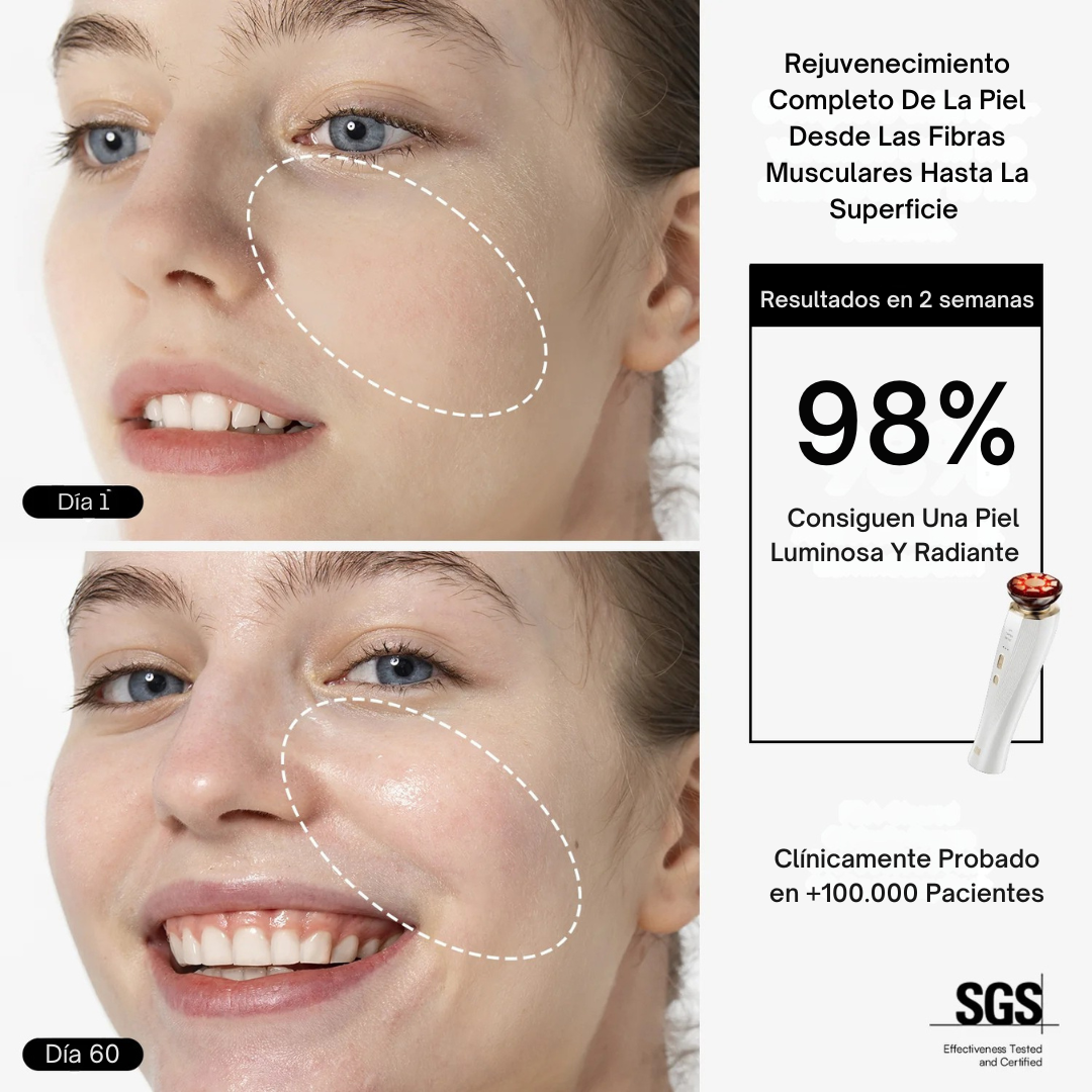 Dispositivo Facial ALUNA™ + Sérum Gratis | Nº1 En SkinCare España