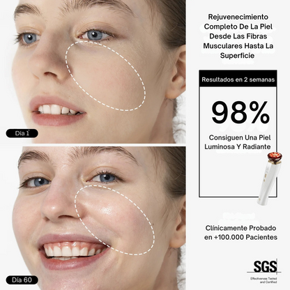 Dispositivo Facial ALUNA™ + Sérum Gratis | Nº1 En SkinCare España